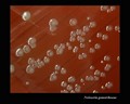 neisseria gonorrhoeae
